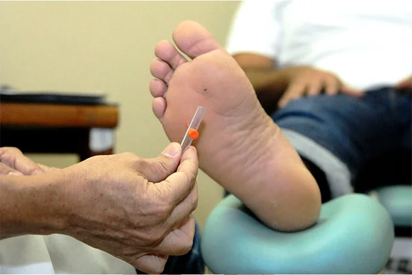 Cenfe oferece prevenção personalizada para pacientes com pé diabético