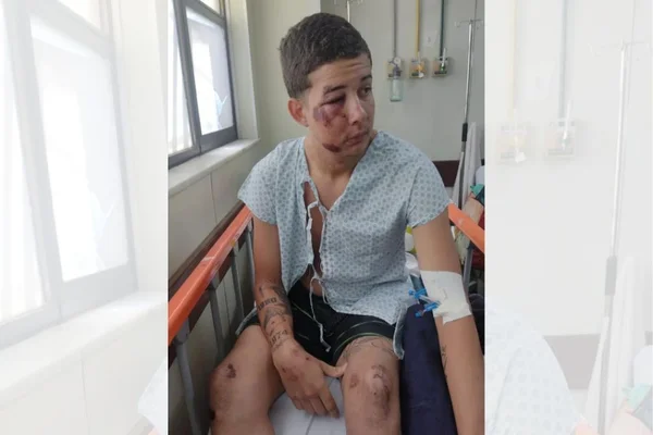homem sentado em cadeira de hospital com machucados