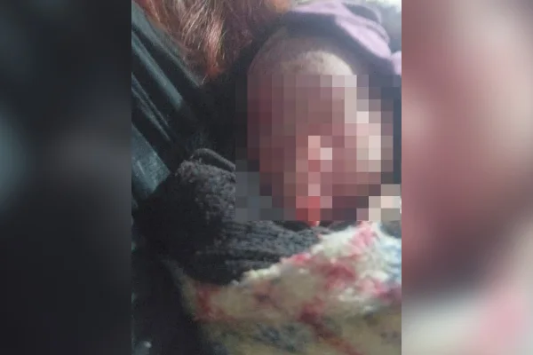 Mulher encontra recém-nascida no lixo: “Achou que era o gato chorando”