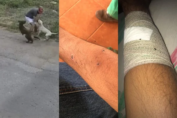 Vídeo: jovem usa técnica de defesa e escapa de ataque de pit-bull em MT