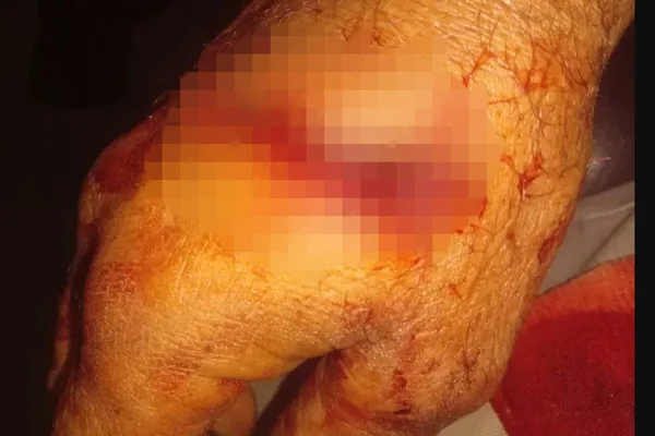 caminhoneiro recebe mordida de jacaré ao tentar salvá-lo