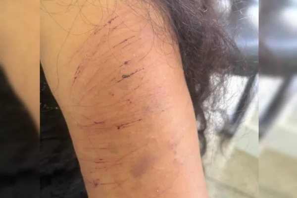 Mulher agredida Luziânia