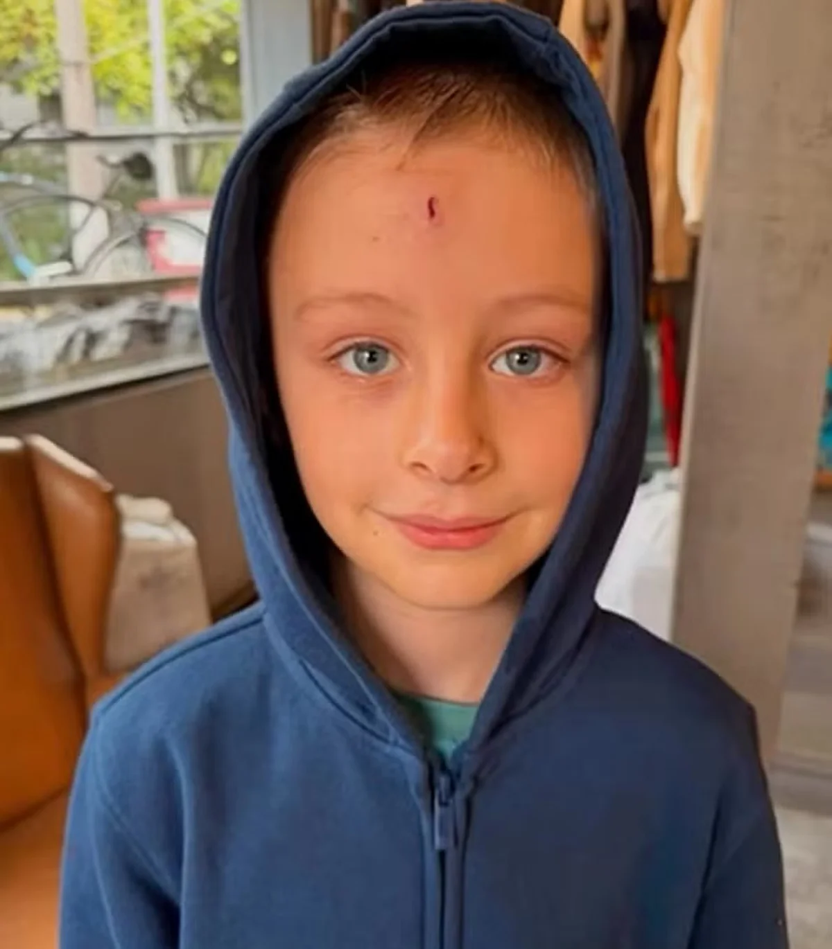 Shantal Verdelho contou como foi o acidente do filho Shantal Verdelho contou como foi o acidente do filho