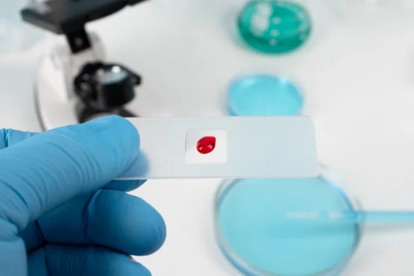 Imagem colorida de amostra de gota de sangue. Metrópoles