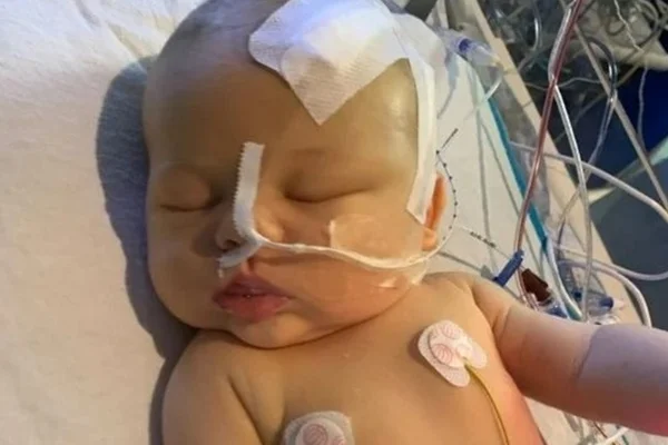Imagem mostra bebê com curativo na cabeça e cânula no nariz - Metrópoles