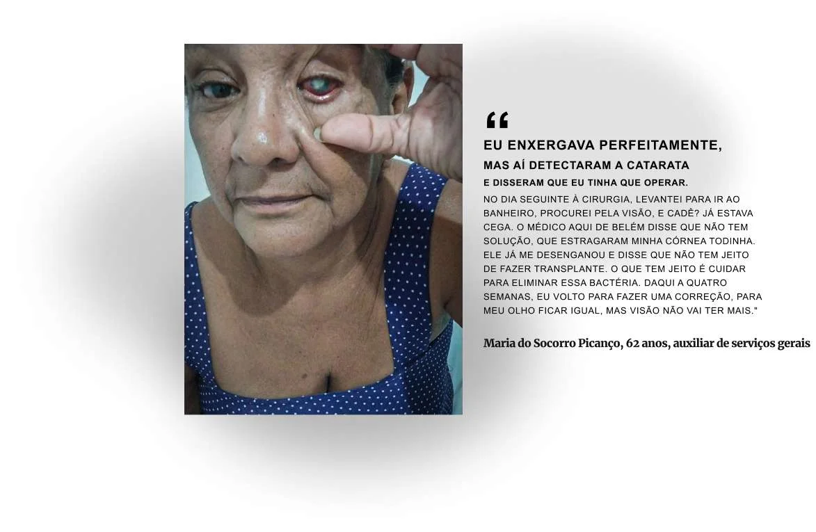 Maria do Socorro chegou a ser transferida para Belém, mas foi informada pelos médicos que não voltará a enxergar do olho operado Maria do Socorro chegou a ser transferida para Belém, mas foi informada pelos médicos que não voltará a enxergar do olho operado