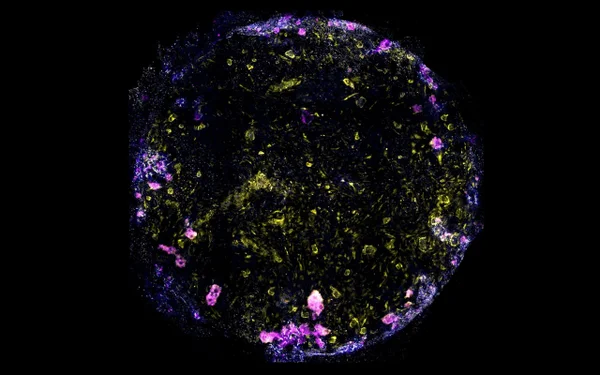 Imagem do pulmão em chip, com núcleos celulares em azul, macrófagos em magenta, células endoteliais em amarelo e junções estreitas entre células epiteliais e endoteliais em branco. Pesquisa foi feita para avaliar tuberculose em mini-pulmão