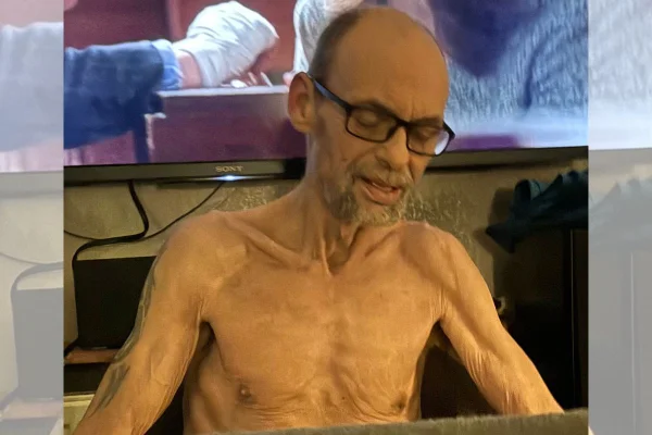 Foto de homem magro, após perder 22 kg - Metrópoles