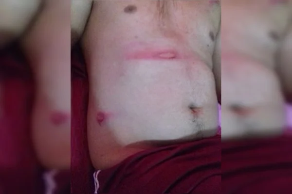 Pai denuncia PMs por abuso de autoridade e agressão ao seu filho em GO