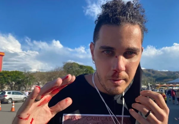 Cinegrafista da GloboNews é agredido por bolsonarista em Aparecida