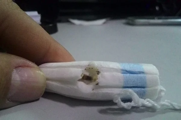 Jovem encontra vermes dentro de absorvente interno