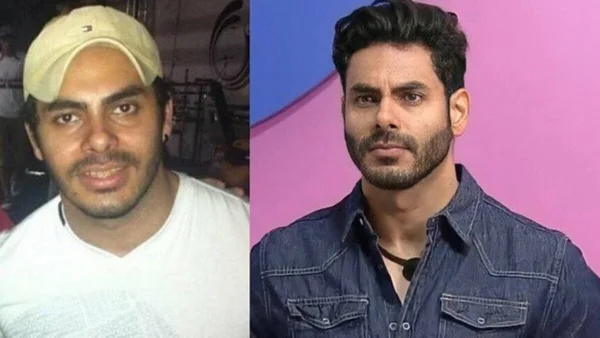11 antes e depois chocantes de BBBs e ex-BBBs