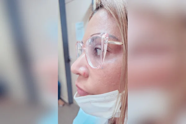 rosto de mulher com machucado no nariz