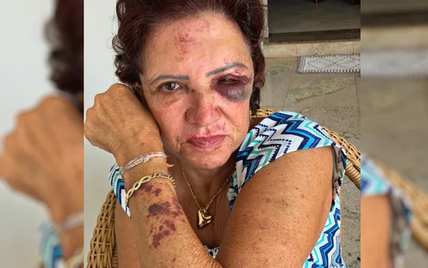 Criminosos assaltam e espancam idosa que rezava em casa