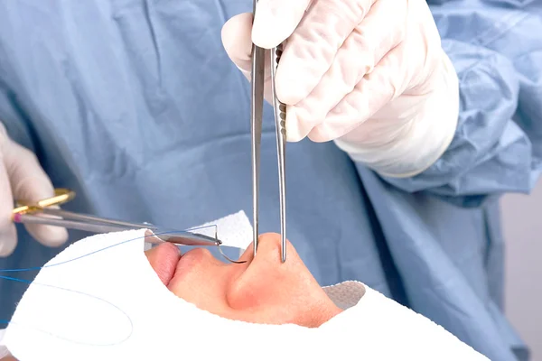 Imagem colorida de pessoa em cirurgia para desvio de septo - Metrópoles