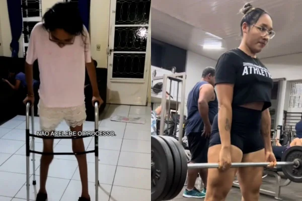 Foto colorida de uma jovem antes e depois - Metrópoles