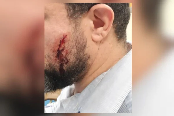 Policial legislativo fica ferido no rosto após ataque de manifestante