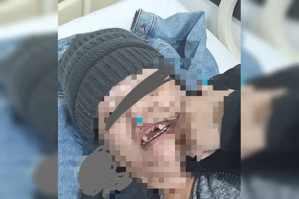 Águas Claras: veja como ficaram dentes de mulher agredida por marido
