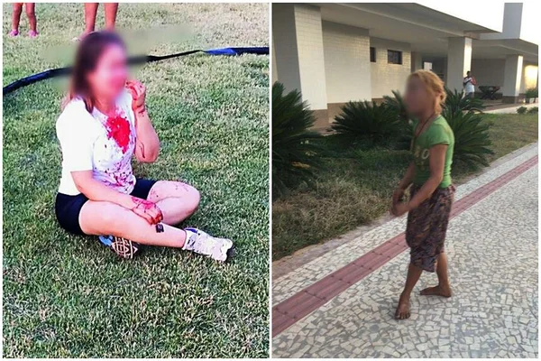 Mulher é espancada por moradora de rua no Noroeste