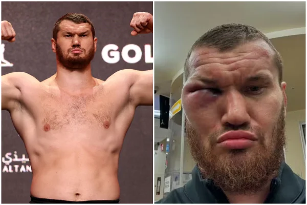 Imagem colorida de antes e depois de boxeador russo- Metrópoles