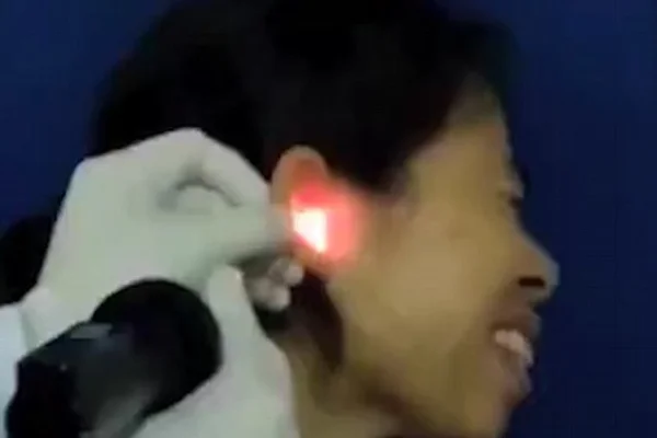 Mulher acorda sentindo dor de ouvido e descobre uma barata lá dentro