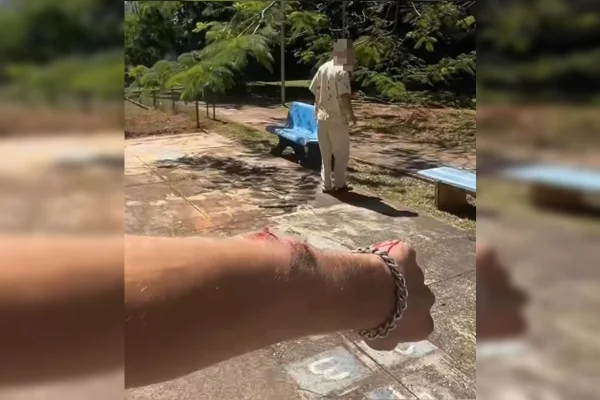 Homem é agredido na Asa Norte, tem braço quebrado após defender mulher