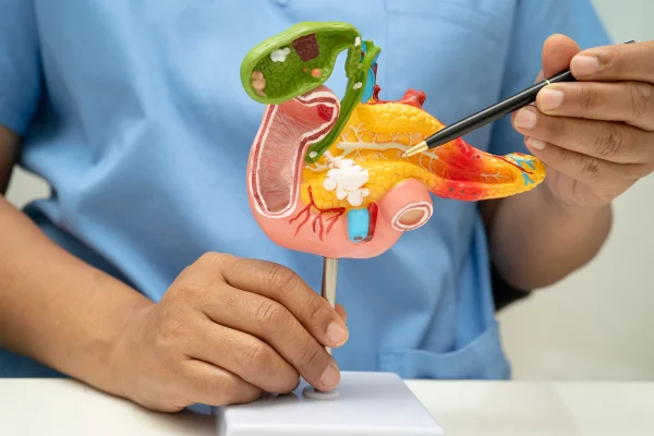 Foto colorida de maquete de pâncreas - Metrópoles