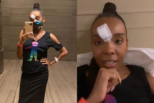Thelma Assis sofre acidente no palco do Criança Esperança: “Pisei em falso”