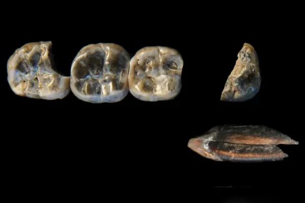 Fotos colorida de dentes fossilizados encontrados na Etiópia - Metrópoles