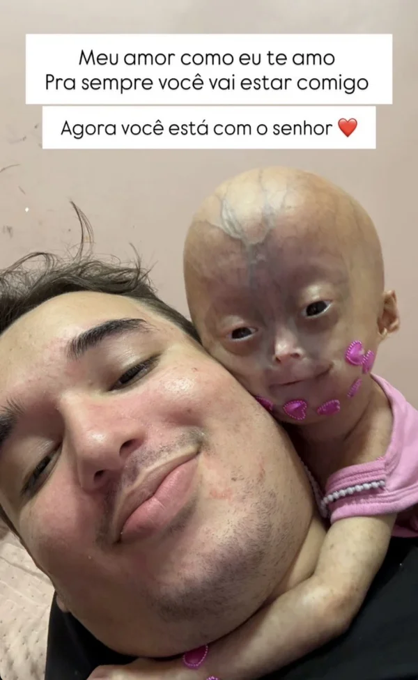 Morre Elis, influencer mirim com síndrome rara de envelhecimento precoce - destaque galeria Morre Elis, influencer mirim com síndrome rara de envelhecimento precoce - destaque galeria