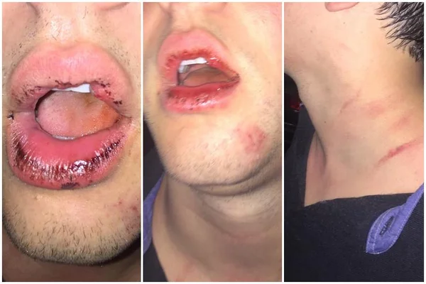 Jovem do DF denuncia agressão de seguranças em boate de Florianópolis