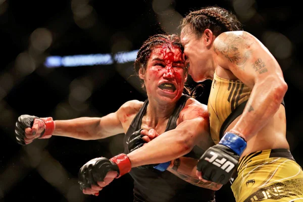 Rival de Amanda Nunes é atendida por cirurgião plástico após derrota