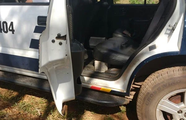 Homem de 51 anos tem pedra de 1,3kg e 18cm retirada da bexiga