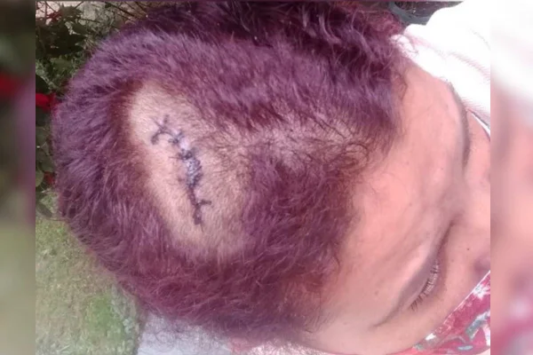 Imagem colorida de corte em cabeça de uma mulher - Metrópoles