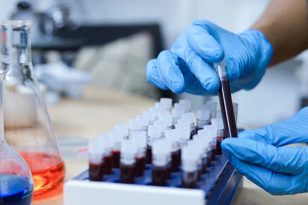 Pesquisa de sangue, mão de cientista segurando tubo de ensaio com sangue em laboratório. Metrópoles