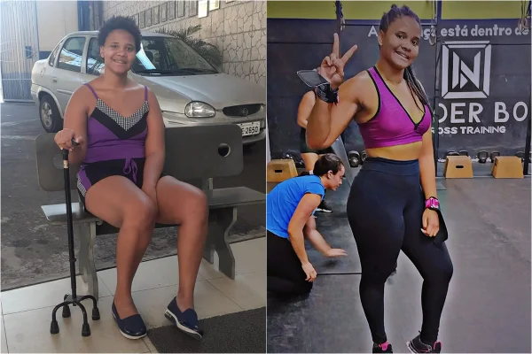 Duas fotos: na primeira, mulher sentada com bengala, na segunda, em academia - Metrópoles
