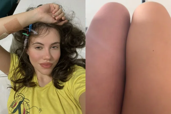 Sarah Femina estava gravando uma publicidade quando sentiu dor na perna esquerda. A atriz paulista foi diagnosticada com trombose profunda - Metrópoles