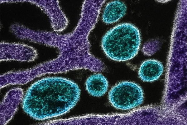Imagem colorida artificialmente mostra o vírus nipah - Metrópoles