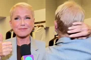 Xuxa passou por transplante capilar em 2025 Xuxa passou por transplante capilar em 2025