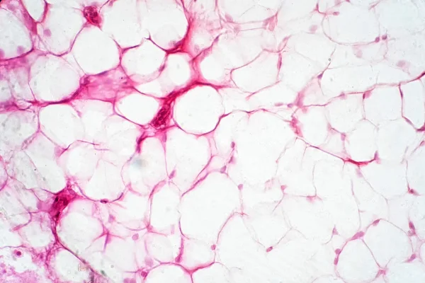 Tecido adiposo humano visto ao microscópio para fins educacionais de fisiologia. Queima de calorias. Metrópoles