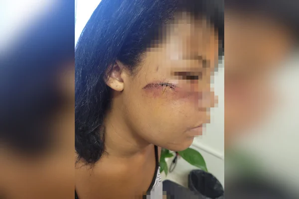 lesão em bochecha de mulher