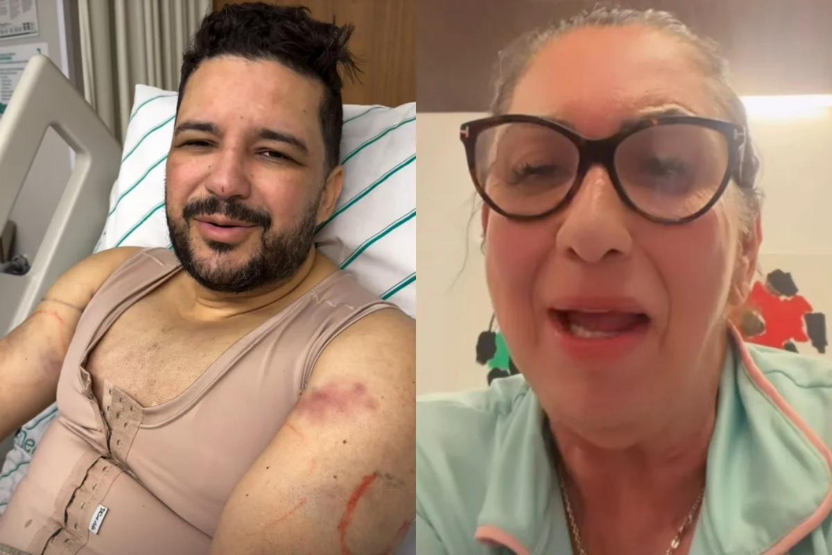 padrasto-de-virginia-faz-lipo-as-escondidas-e-surpreende-margareth