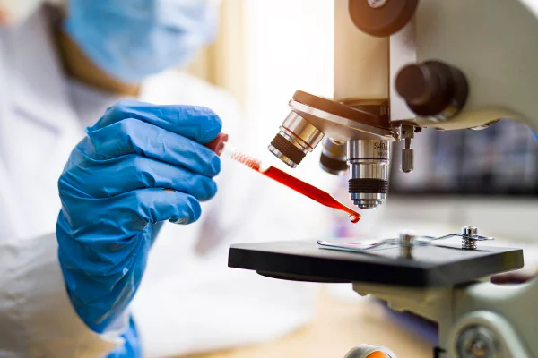Fotografia mostra cientista com luva azul colocando amostra de sangue em microscópio - Metrópoles