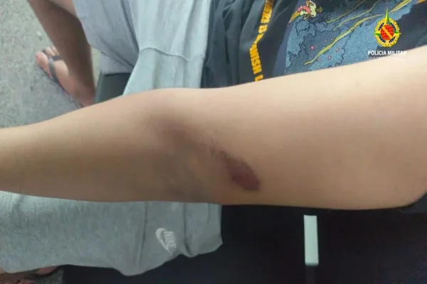 Trio de adolescentes dá rasteira, socos e rouba menino de 15 anos