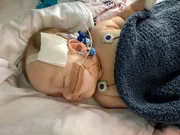 O tipo mais comum é o 1 e corresponde a 60% dos casos — os sintomas aparecem antes dos seis primeiros meses de vida, e a criança pode perder a capacidade de se movimentar ainda no primeiro ano, bem como a autonomia do sistema respiratório O tipo mais comum é o 1 e corresponde a 60% dos casos — os sintomas aparecem antes dos seis primeiros meses de vida, e a criança pode perder a capacidade de se movimentar ainda no primeiro ano, bem como a autonomia do sistema respiratório