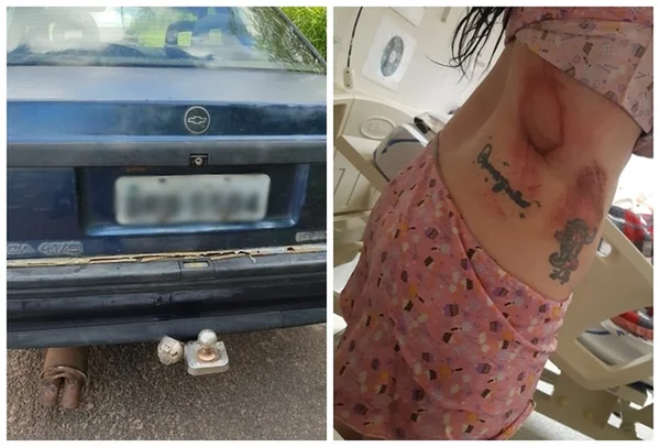 Marcelo Bogaz, de 43 anos, amarrou o pescoço da namorada de 30 anos com uma mangueira no engate do carro