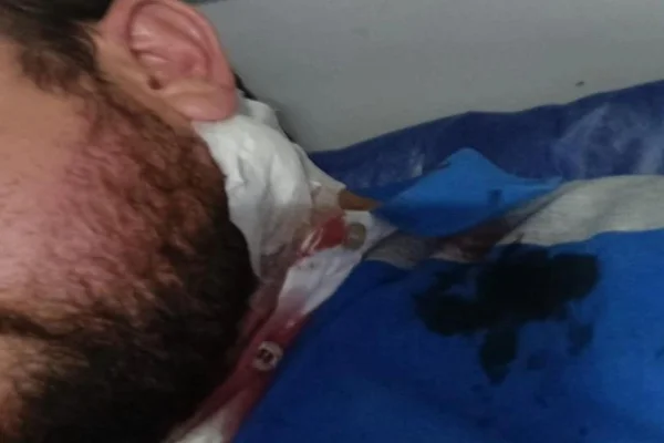 Imagem colorida, homem com o pescoço enfaixado - Metrópoles