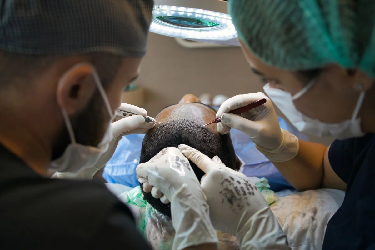 Transplante capilar vs. barba: entenda as principais diferenças