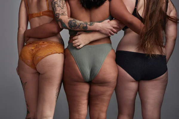 Imagem mostra três mulheres de costas, de bikini, mostrando a celulite - Metrópoles
