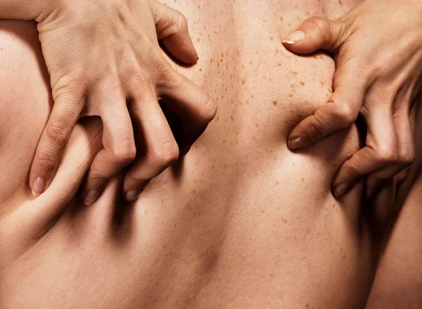 Foto colorida em close de duas mãos femininas apertando a pele das costas de um homem - Metrópoles